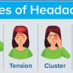 What does a pinched nerve headache feel like?